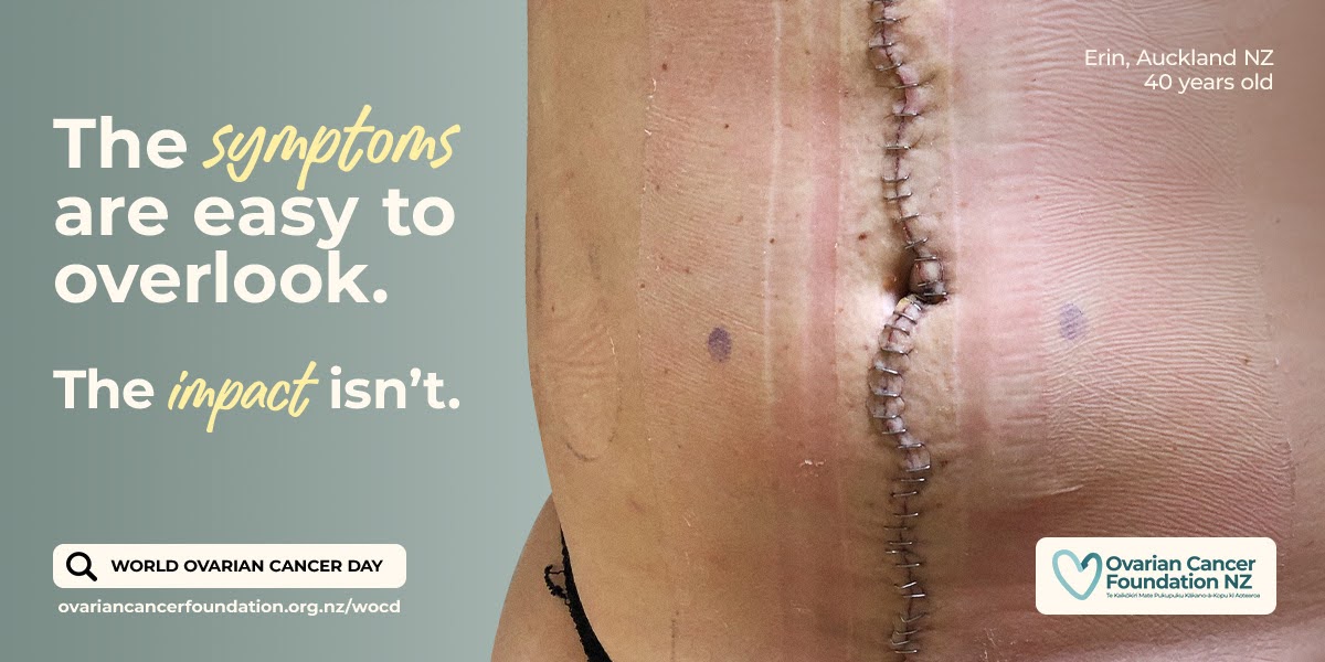 a photo of a woman's ovarian cancer abdominal scar with the eords the symptoms are easy to overlook, but the impact isn't